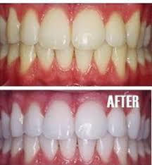 Activated Carbon Whitening Toothpaste-VIRAL BEAUTY TRENDS