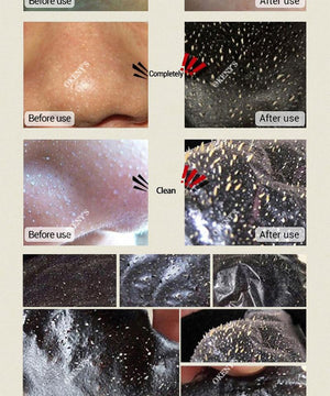 Deep Cleansing Black Mask - Blackhead and Impurity Remover-VIRAL BEAUTY TRENDS